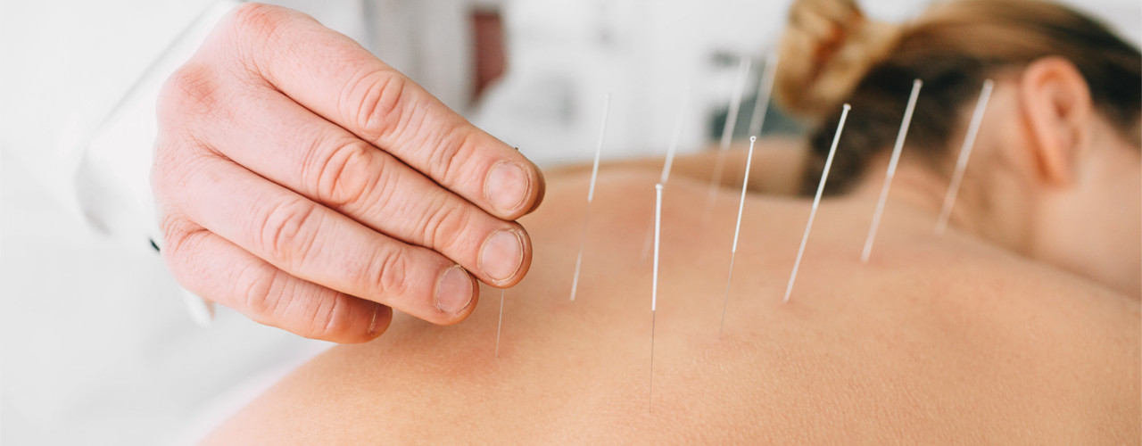 acupuncture Anatomy Physiotherapy Clinic Ottawa, Ontario