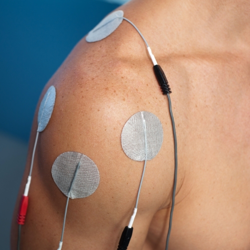 electrical-stimulation-anatomy-physiotherapy-clinic-orleans-st-laurent-westboro-stittsville