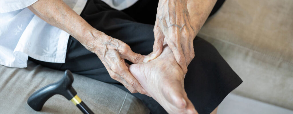 How to Manage Foot Pain from Arthritis